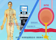 人和醫(yī)院 尿潴留、尿失禁動畫